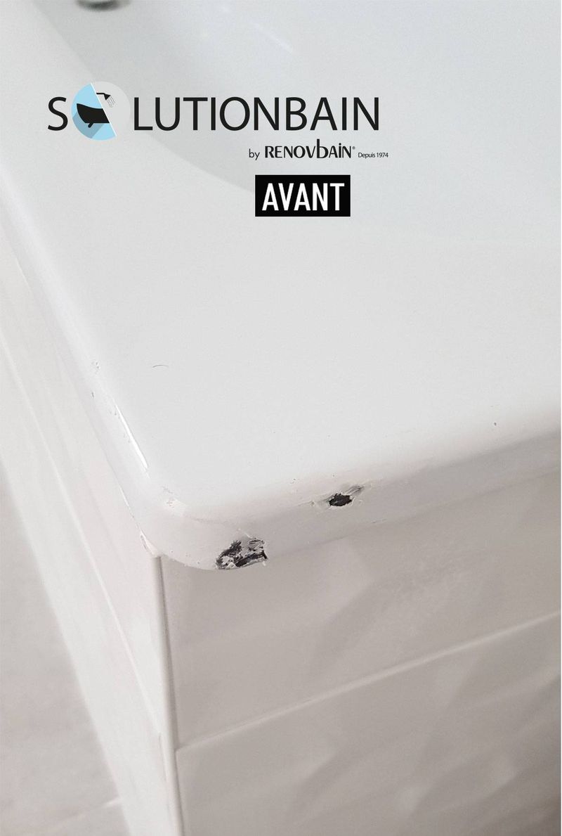 Réparation éclats d'émail SolutionBain